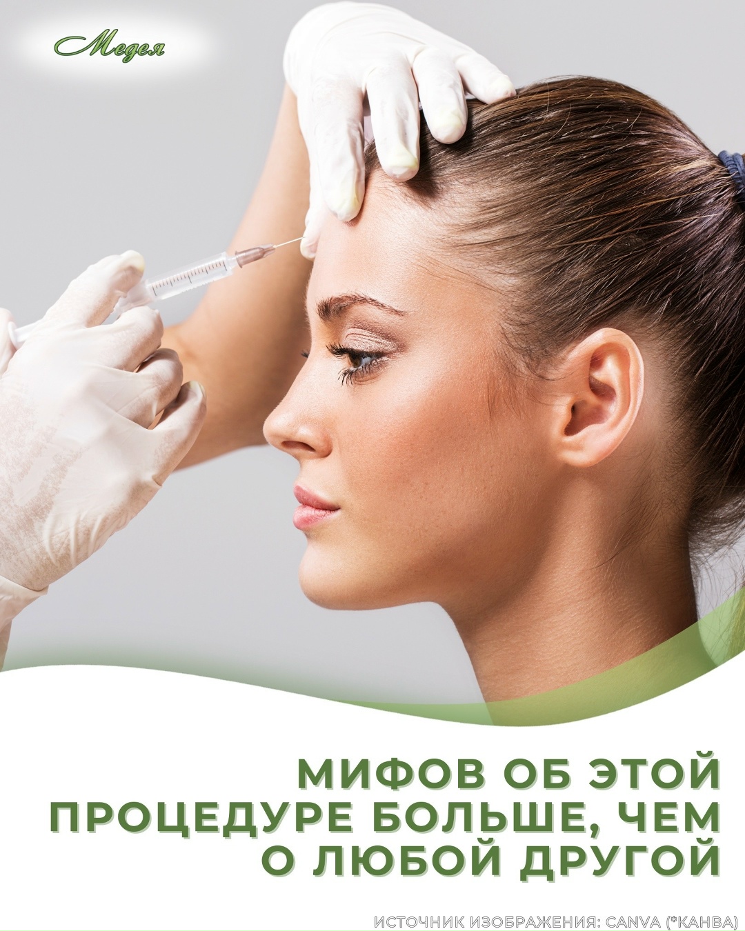 Ботулинотерапия