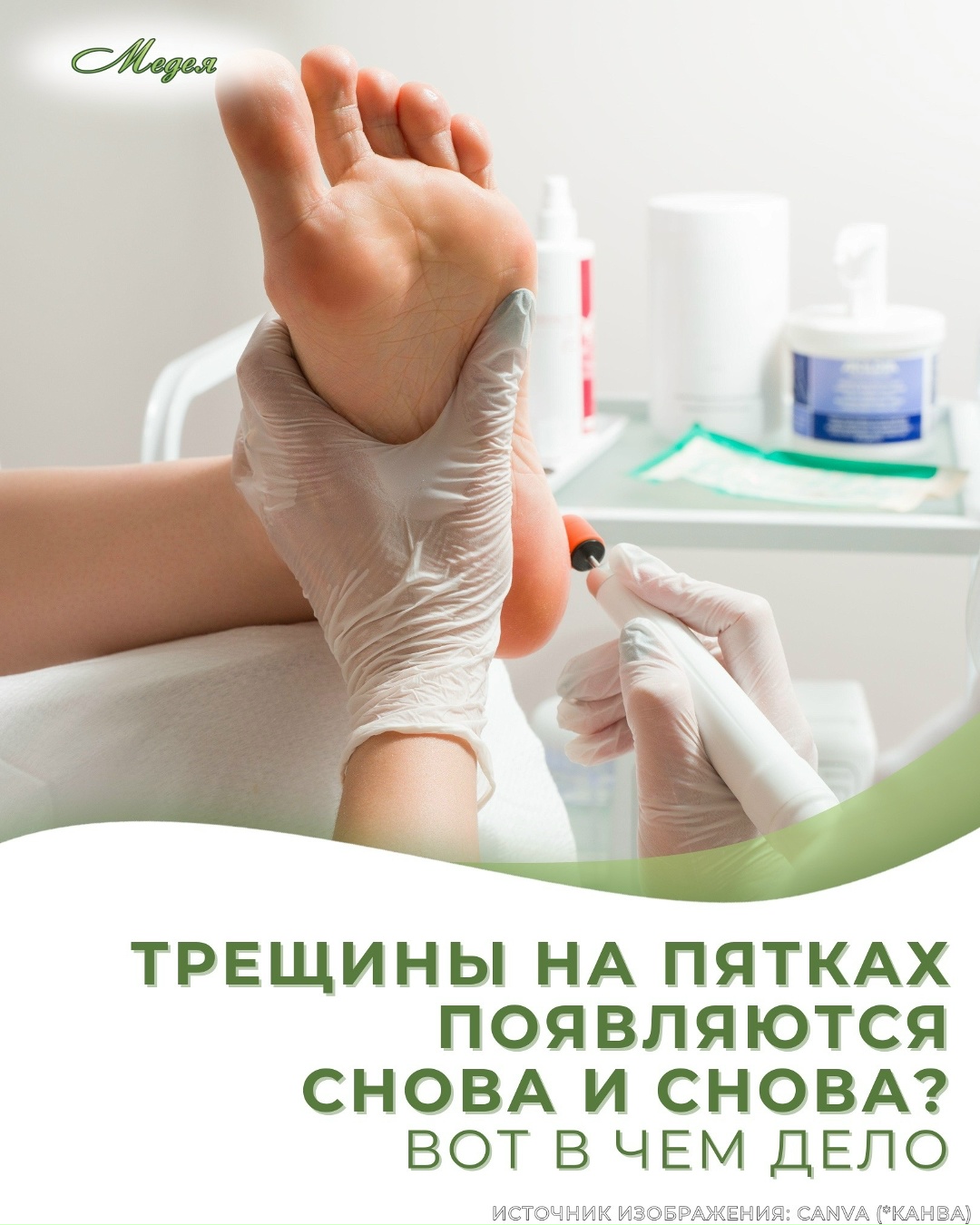 Трещины на пятках