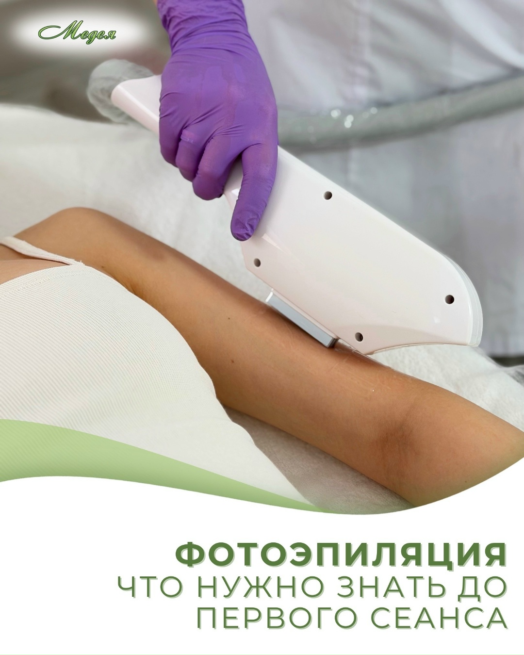 Фотоэпиляция